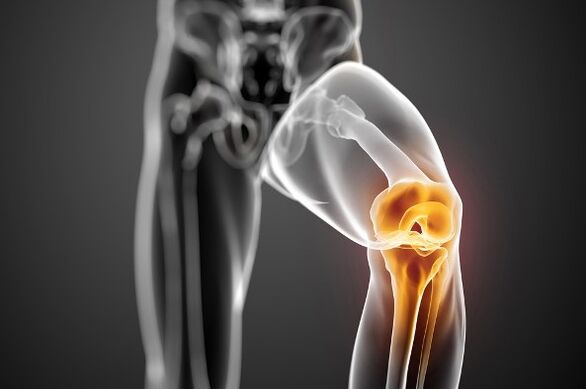 Arthrose des Kniegelenks