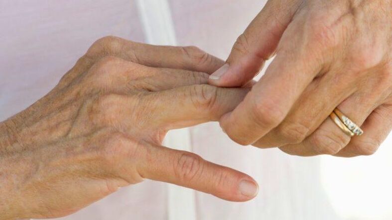 In welchen Krankheiten die Fingerverbindungen verletzen