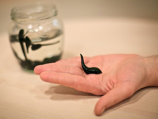 Anwendung zur Behandlung von Arthrose des Kniegelenks